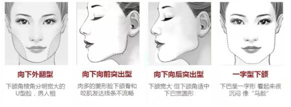 磨骨手術(shù)的原理