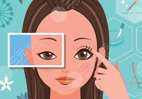 10個開內(nèi)眼角9個留疤怎么辦？怎么避免開眼角留疤？注意事項帶你了解！