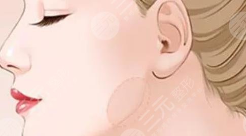 金一秀磨骨價格多少