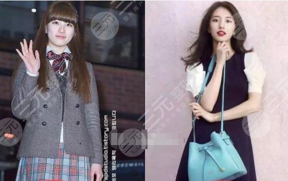 裴秀智微調(diào)整容參考標(biāo)準(zhǔn)！變美拿下李敏鎬，來看看她整了哪里！