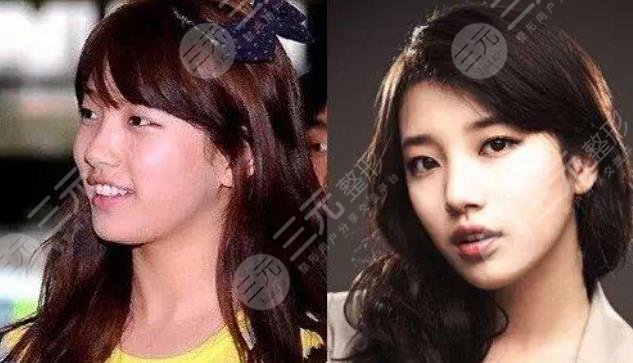 她動了哪些地方?