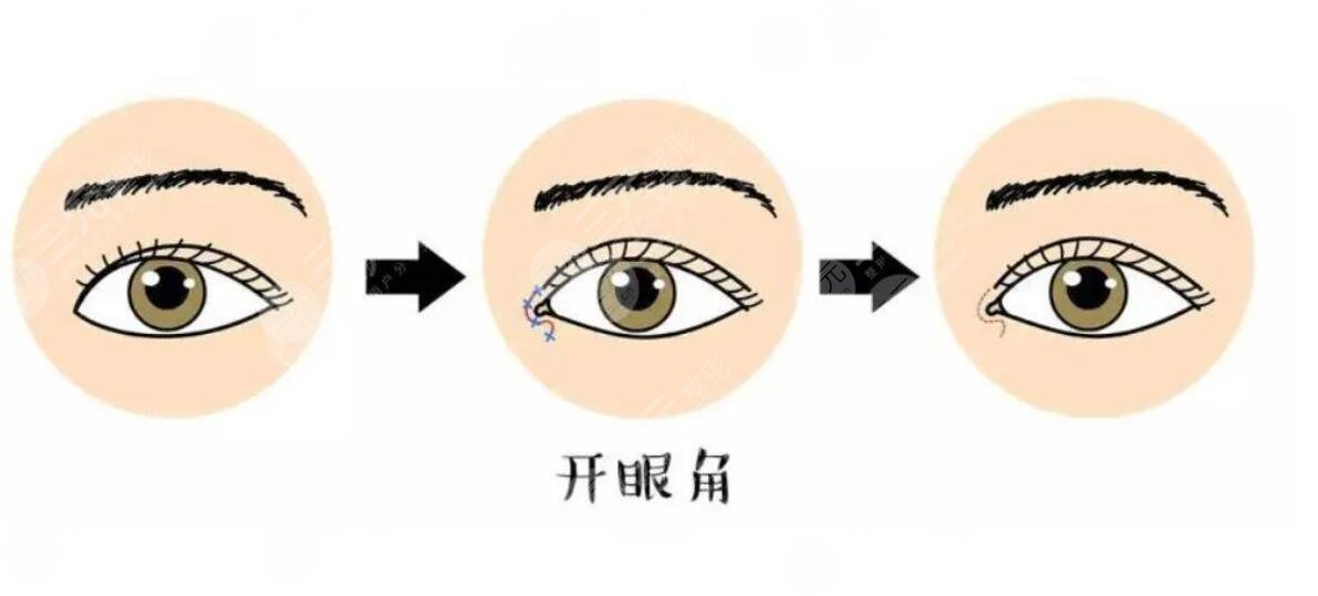 開眼角