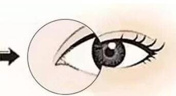 開眼角