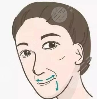 湘雅醫(yī)院整形科韓式生科硅膠假體案例果對比圖|內(nèi)附價格表