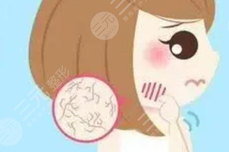 成都天之美整形怎么樣？激光祛紅血絲果反饋