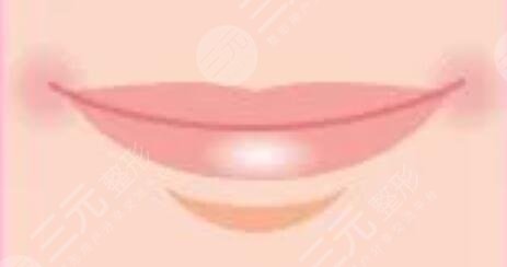 漂唇恢復(fù)七天過(guò)程圖，附個(gè)人漂唇經(jīng)歷過(guò)程圖片