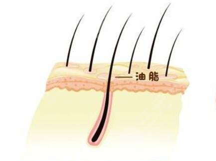 深圳陽光醫(yī)院植發(fā)靠譜嗎？發(fā)際線植發(fā)怎么樣？附術(shù)后果