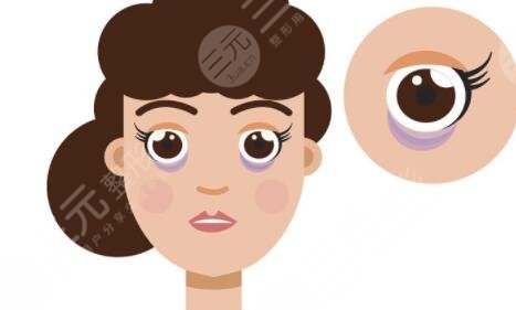 貴州省人民醫(yī)院外切眼袋手術(shù)案例，讓愛美者快速去眼袋