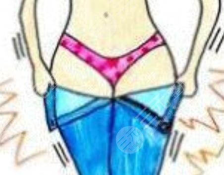 抽脂吸脂果:恢復(fù)過程