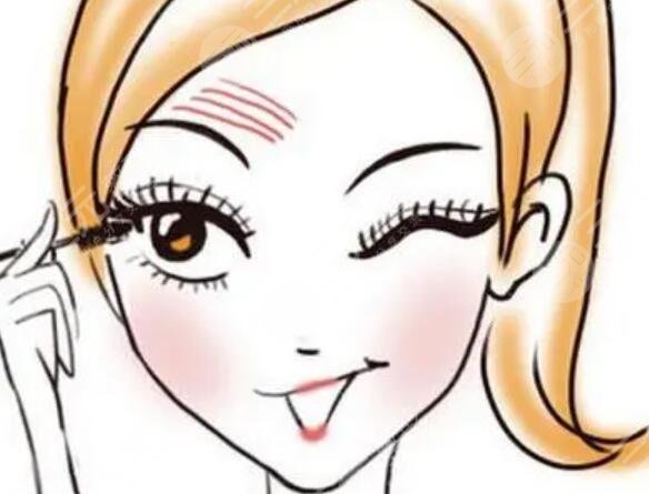 開眼角手術之后13天