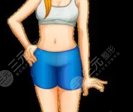 上海愛(ài)都瀘美人大腿吸脂案例