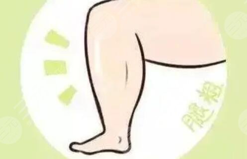 深圳微姿醫(yī)療整形醫(yī)院大腿吸脂案例