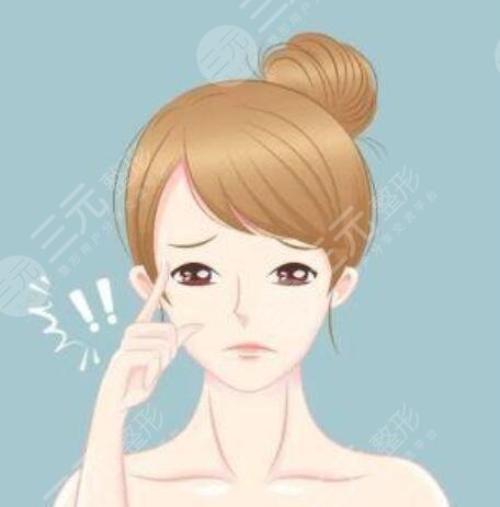 漢中中心醫(yī)院雙眼皮案例術(shù)后30天