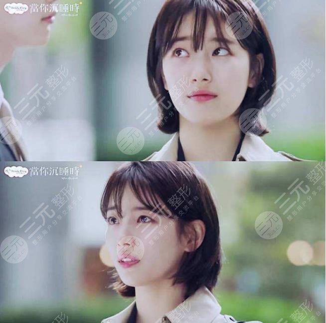 裴秀智微整泡到李敏鎬！從土氣女孩到韓劇女主？她動了哪些地方？