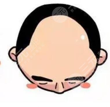 上海第九人民醫(yī)院植發(fā)掛什么科