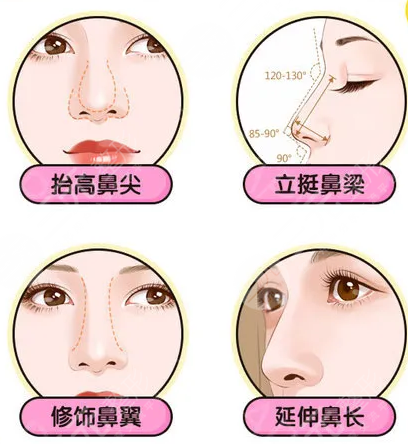 華美李超做鼻子后90天