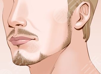 烏魯木齊雍禾植發(fā)醫(yī)院胡須種植經(jīng)歷分