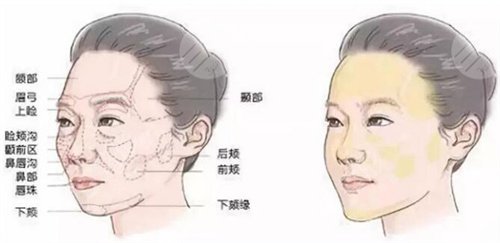 真人體驗熱拉提果反饋術(shù)前