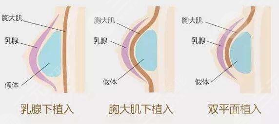 娜綺麗和傲諾拉哪款好？