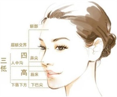 下巴吸脂前后對比照片術后3個月