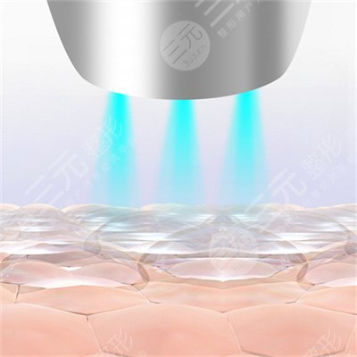 第四代熱瑪吉和第新一代熱瑪吉有什么區(qū)別