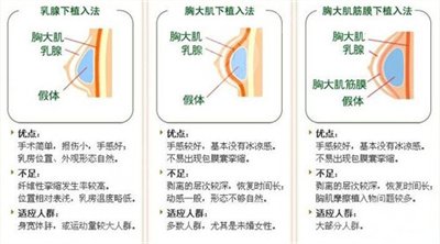 假體隆胸恢復(fù)果圖片分享，記錄術(shù)后每一天的變化~