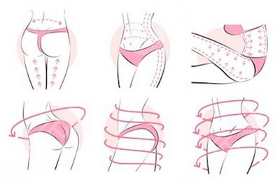 張清峰醫(yī)生大腿吸脂案例