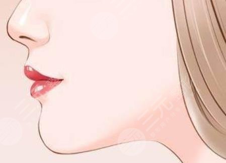 下巴填充