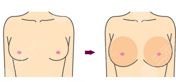 魔滴和曼托怎么選擇？魔滴和曼托的區(qū)別有哪些？