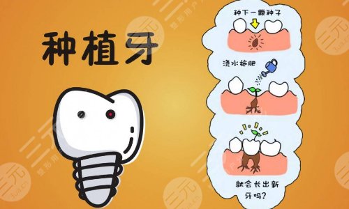 口腔問(wèn)答三：種植牙手術(shù)疼嗎?