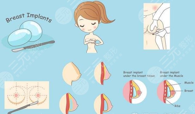 假體隆胸手術(shù)術(shù)前有哪些注意事項(xiàng)?