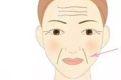 上海芮雅整形醫(yī)院去抬頭紋案例