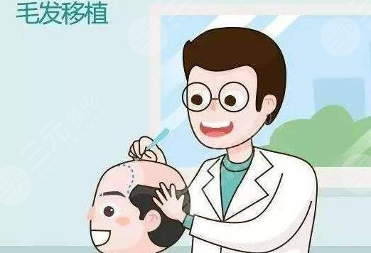 植發(fā)技術都有哪些操作方式?