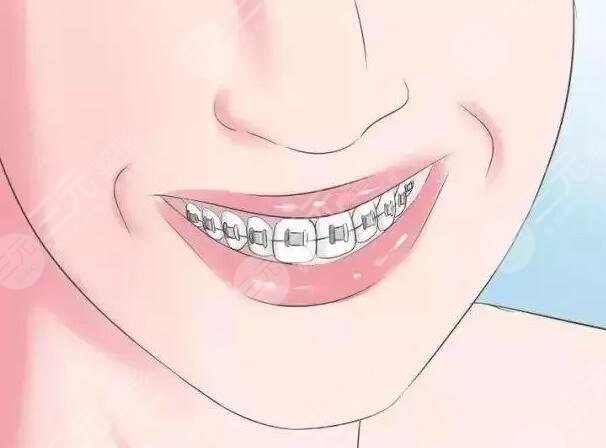 北京大學深圳醫(yī)院正畸案例