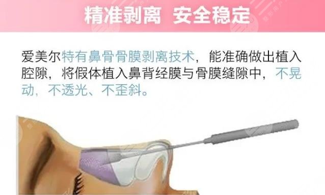 美迪菲假體和韓式生科哪個(gè)好?哪個(gè)貴?美迪菲假體