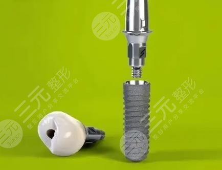 做種植牙的第一步:術(shù)前準(zhǔn)備