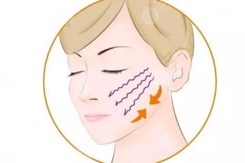 哪些因素影響臉部提拉手術(shù)費(fèi)用