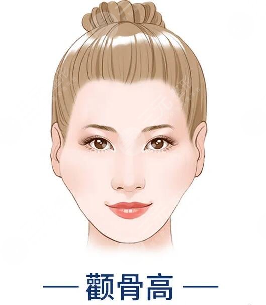 磨顴骨前后對比圖驚掉網(wǎng)友下巴！術(shù)后告別兇巴巴的氣場，秒變甜美萌妹~