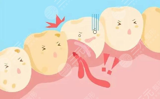 健康牙齦的顏色是什么顏色的？白色更健康是真的嗎？事實(shí)會突破你的認(rèn)知~