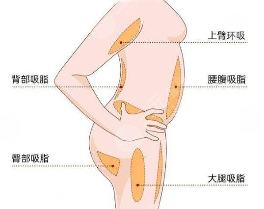 光纖溶脂瘦大腿術后注意事項