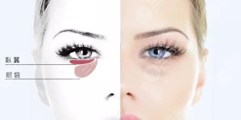 下眼袋浮腫怎么辦?