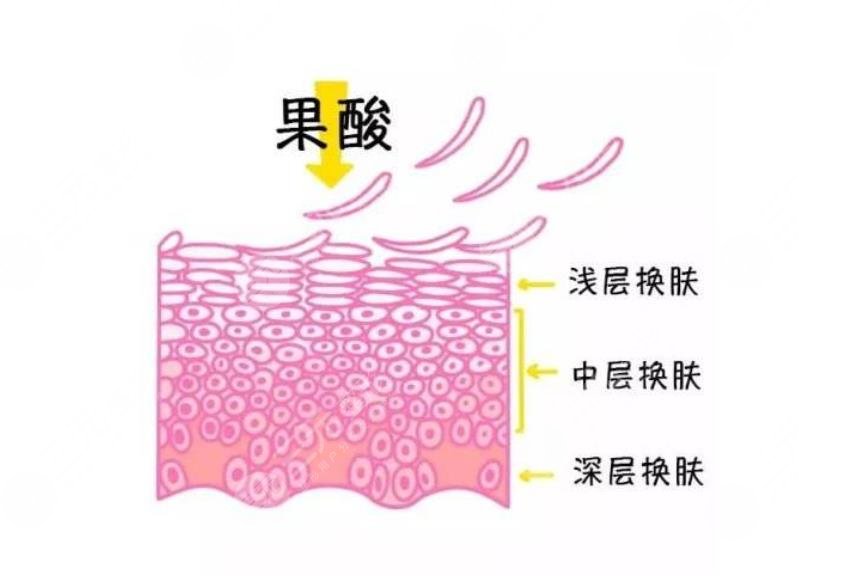 去角質(zhì)的正確方法盤?點(diǎn)!