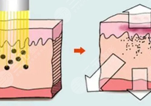 快速變白的方法有哪些?