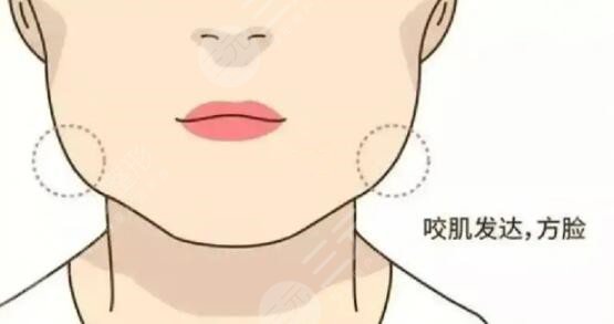咬肌怎么變小快速的方法不動刀！照搬文中的方法可以讓你更快的變小臉~