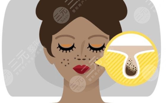 去黑頭收縮毛孔