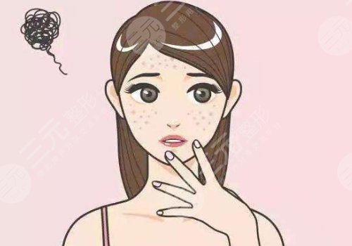 臉上的色斑怎么去掉?
