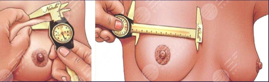 豐胸的優(yōu)勢