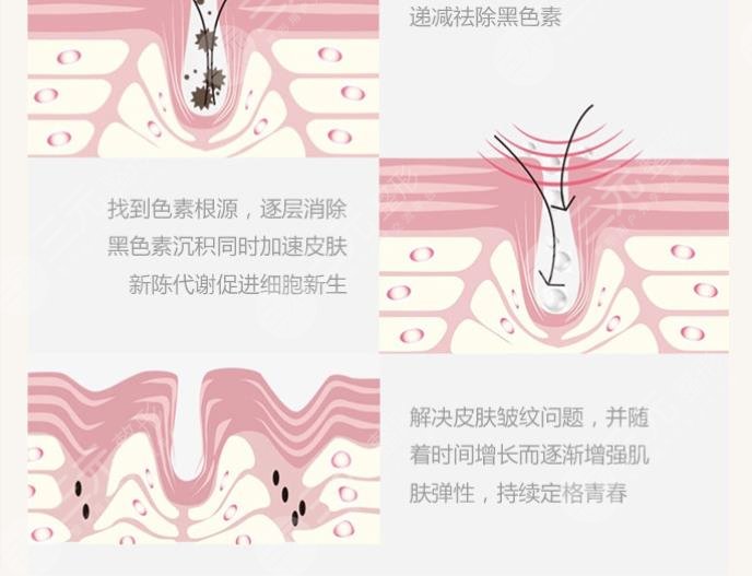 有了黑眼圈怎么治?還能消嗎?小妙招