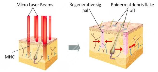 眼圈很?chē)?yán)重怎么改良?
