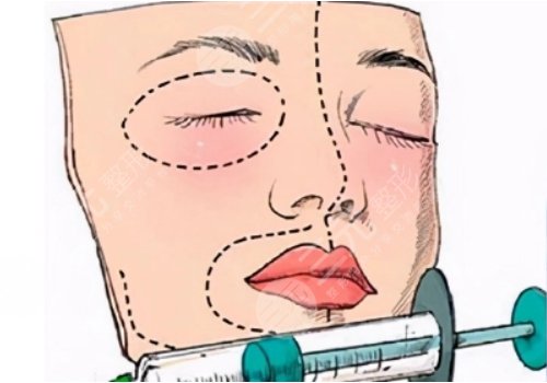 河南中醫(yī)藥大學(xué)第一附屬醫(yī)院整形美容科怎么樣?